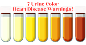 7 Urine Color Heart Disease Warnings!