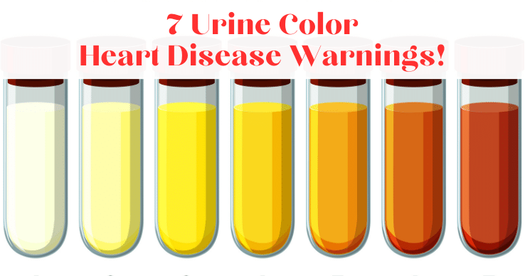 7 Urine Color Hear -Disease Warnings!